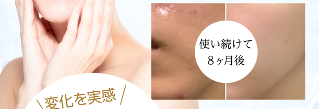 使い続けて8ヶ月後 比較